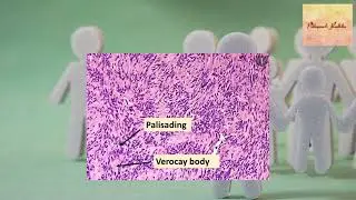 Pathopearls_radhika