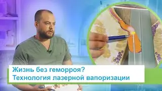 Геморрой, анальные полипы и трещины — есть решение! Жизнь без боли с лазерной хирургией