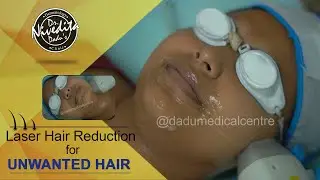 Laser Hair Reduction Face Treatment | Procedure Video