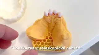 Zkouška teleskopické zubní náhrady