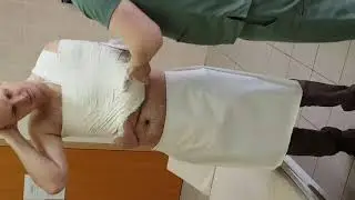 Гипсовый бинт из аптеки 100% говно