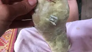 How to removal skin | callus removal skin flakes #35