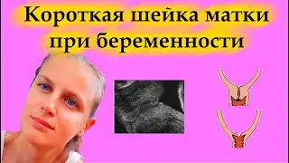 Вагинальные осмотры во время беременности. Короткая шейка матки. Надо ли паниковать?