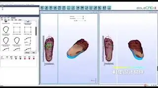 Изготовление 3D стелек в международном реабилитационном центре Нейролайф