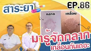 สาระยา | มารู้จักกลาก เกลื้อนกันเถอะ | EP.86