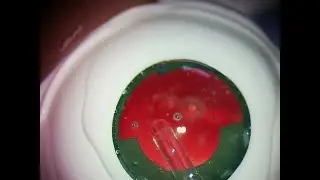 SimulEYE Capsule Support with CTR