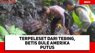 Terpeleset dari Tebing, Betis Bule Amerika Putus