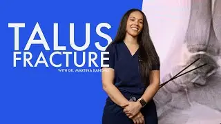 Talus Fracture