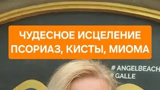 Чудесное исцеление ПСОРИАЗА. ПСИХОСОМАТИКА сработала! Делюсь эмоциями