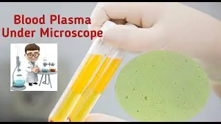 Plasma microscope