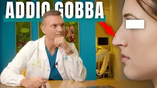 Ultrasonic Rhinoplasty and Preservation Rhinoplasty: 5 Incredible Benefits | Dr. Dario Rochira
