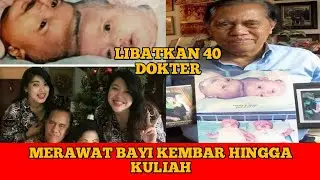 DOKTER BAIK HATI OPERASI KEMBAR SIAM PERTAMA DI INDONESIA‼️