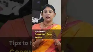 Tips to heal Cesarean scar faster #delivery #pregnancytips #cesareanscartips #drsavitha #udumalpet