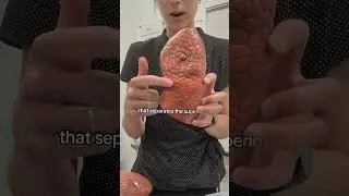 Lung Anatomy Basics: Part 1