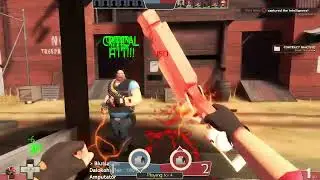 I think I downloaded the wrong TF2