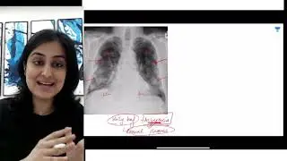 🔥Rapid Fire🔥 Must-Know Images Part 11 | Dr Zainab Vora