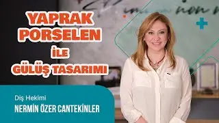 Yaprak Porselenler İle Gülüş Tasarımı
