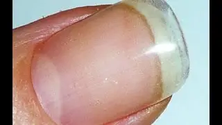 IBD SOAK OFF GEL REFILL