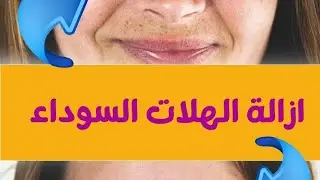 ازاي اشيل الهالات السودة تحت العين ب الفوتشوب _how to remove black skin under eyes by Photoshop 2023