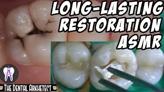 Applying Some BIOMIMETIC Principles in a Tooth Restoration 4K #C13