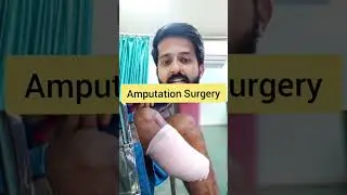 Diabetic Neuropathy | Diabetes Awareness | Gangrene | Amputation | Dr Vaibhav Awasthi