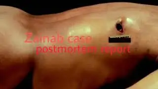 Zainab Case Postmortem Report NEW NEWS TODAY