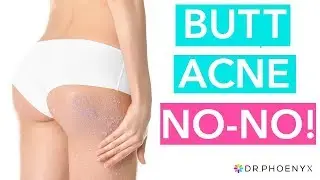 Got Butt Acne or Butt Pimples? Don’t Do This!