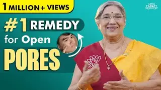 How to treat OPEN PORES | Enlarged Pores - Causes & Treatment | Natural Skincare Remedies