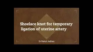 Tips for learning Shoelace knot  for temporary ligation of uterine artery at origin.