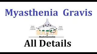 Myasthenia Gravis