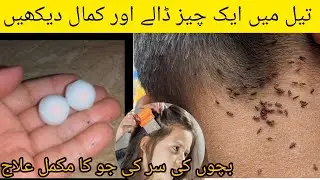 Say Bye Bye" Forever to Head Lice #lice #treatment