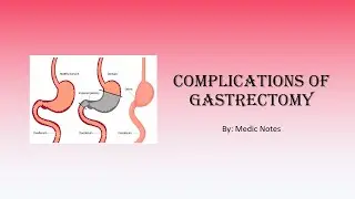 Complications of gastrectomy