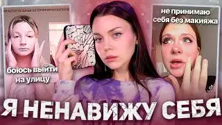 I HATE MY REFLECTION | what is life like with body dysmorphic disorder