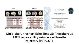 Multi-site UTE 3D Phosphorous MRSI repeatability using novel Rosette Trajectory (PETALUTE)