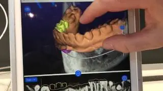 Acteon auf der IDS 2017