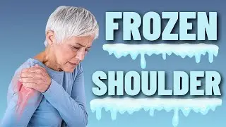 Frozen Shoulder: Causes, Treatment & Exercises