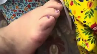 My grandmas feet (reupload)