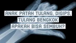 anak patah tulang, digips, bengkok, apakah bisa sembuh?