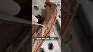 Forearm extensor muscle #2 | Anatomy Upper Limb | #mbbs #neet #viral #shorts