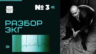 Разбор ЭКГ №3