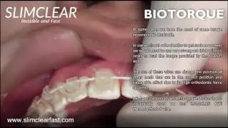 Biotorque - SlimClear