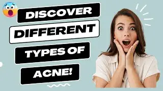 Discover the Various Types of Acne for Clear Skin! 👀✨
