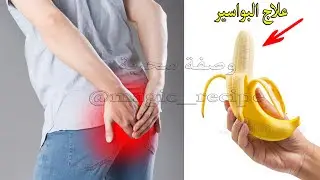 سأنفع بها من هو محتاج لها بالموز فقط ستشفى من البواسر لا جراحة ولا طبيب