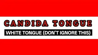 Candida Tongue : Causes, Symptoms & How To Get Rid Of It