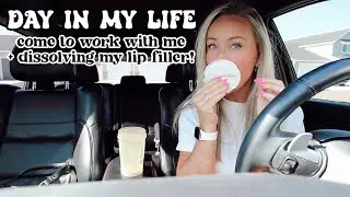 DAY IN MY LIFE VLOG // come to work with me + dissolving my lip filler appt