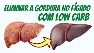 ESTEATOSE HEPÁTICA DÁ PRA CURAR COM LOW CARB?