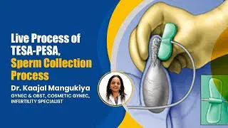 Live Process of TESA_PESA, Sperm Collection Process, Male infertility Treatment in Vesu, Surat