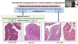 4 из 7. Алгоритм диагностики папиллярных поражений