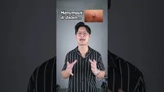 The Hidden Reason Why We Can't Pop Pimples