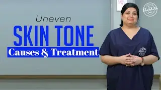 Patchy or uneven skin tone | Causes, remedies, medications and treatments